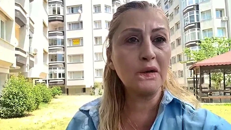Antalya'da estetik kabusu! Dudağını kaybeden kadının 7 yıllık hukuk mücadelesi sürüyor